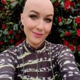 It changed my relationship with beauty: journalist Mary Cate Smith discusses her alopecia journey