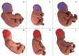 Women give birth in MRI to show baby’s head change shape in labour