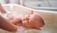 Parents are giving their babies ‘bleach baths’ for eczema