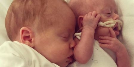 Premature twin born 3 times lighter than his brother left fighting for life