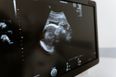 Health: Sims IVF to open satellite clinic in Limerick