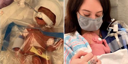 Premature baby born at 22 weeks was initially saved by a plastic bag
