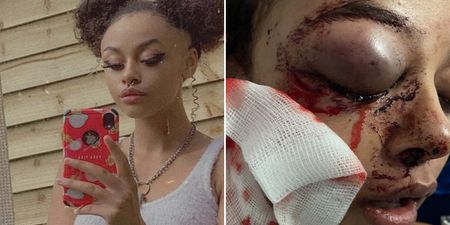 Teenage girl who was brutally attacked in Ballyfermot speaks out