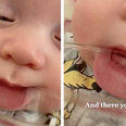 This clever trick makes it easy to know if your baby has started teething