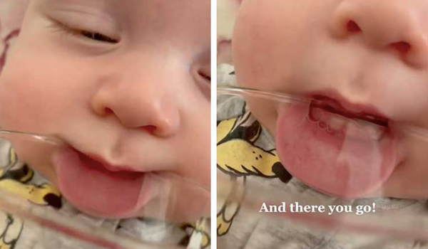 Early teething clearance in babies