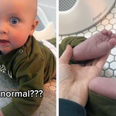 “Is this normal?” Mum shares image of her baby’s purple feet and TikTok-ers help