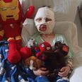 6-year-old boy left “scarred for life” after bullies allegedly set him on fire in US