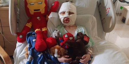 6-year-old boy left “scarred for life” after bullies allegedly set him on fire in US