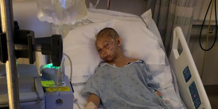 9-year-old girl miraculously survives cougar attack