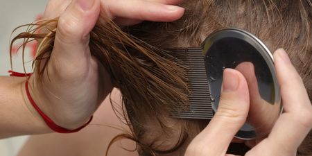 Irish children going without head lice treatment because parents can’t afford it