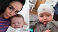 Marnie Simpson reveals her baby boy has plagiocephaly