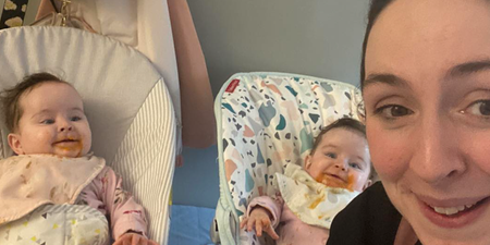 Conjoined twins return to Ireland after successful surgery