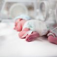 Newborn babies to be screened for severe combined immunodeficiency in Ireland