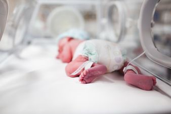 Newborn babies to be screened for severe combined immunodeficiency in Ireland