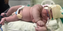 Woman gives birth to baby weighing a huge 16lbs