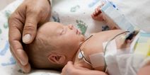 Most premature babies have no long term health issues, study finds