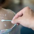 Mum reveals clever hack that stops chickenpox from itching