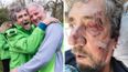 RTÉ’s Charlie Bird rushed to A&E following a bad fall