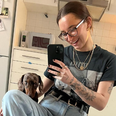 Irish influencer Lucy Fitz shares gruesome photos of “traumatising” dog attack