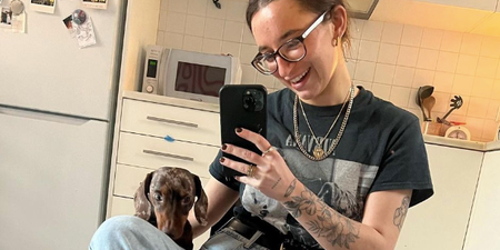Irish influencer Lucy Fitz shares gruesome photos of “traumatising” dog attack