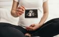 Irish Psychotherapist says birth rates in Ireland are dropping due to cost of living crisis