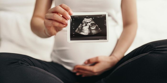 Pregnant woman holding sonogram picture