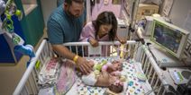 Conjoined twins go home after six hour separation surgery is a succuss