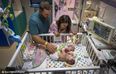 Conjoined twins go home after six hour separation surgery is a succuss