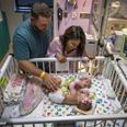 Conjoined twins go home after six hour separation surgery is a succuss