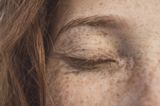 Vhi promises ‘faster and more effective’ dermatology services with latest partnership
