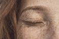 Vhi promises ‘faster and more effective’ dermatology services with latest partnership