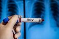 ‘We’ve seen a very significant recent rise’ – HSE warns parents over contagious respiratory disease in kids