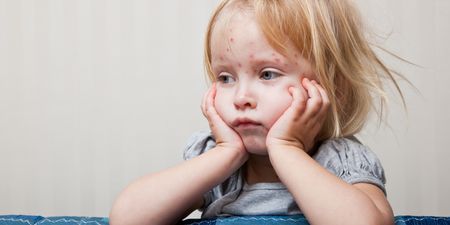 The signs of chickenpox to look out for in kids ‘before the rash appears’