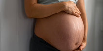 Can you prevent stretch marks in pregnancy?