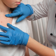 Outbreak of measles in the UK – the main symptoms to look out for