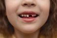 Mum reveals how much the Tooth Fairy pays for her daughter’s teeth due to inflation