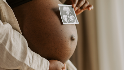 Gestational diabetes cases have doubled in Ireland, experts warn