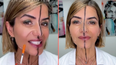Doctor shares side effects of Botox after injecting only one side of her face
