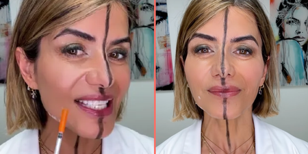Doctor shares side effects of Botox after injecting only one side of her face